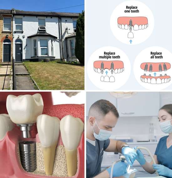 Castle Street Dental practice and implant procedure